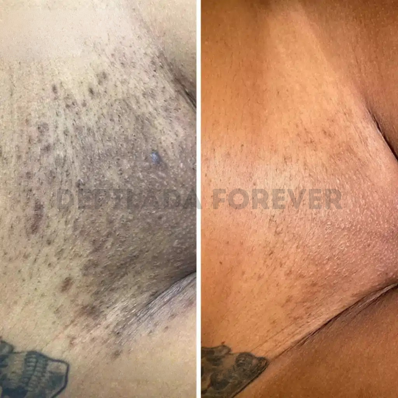 Valeria R. – Piel reactiva