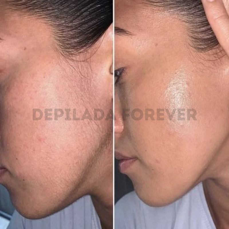Andrea S. – Piernas y axilas