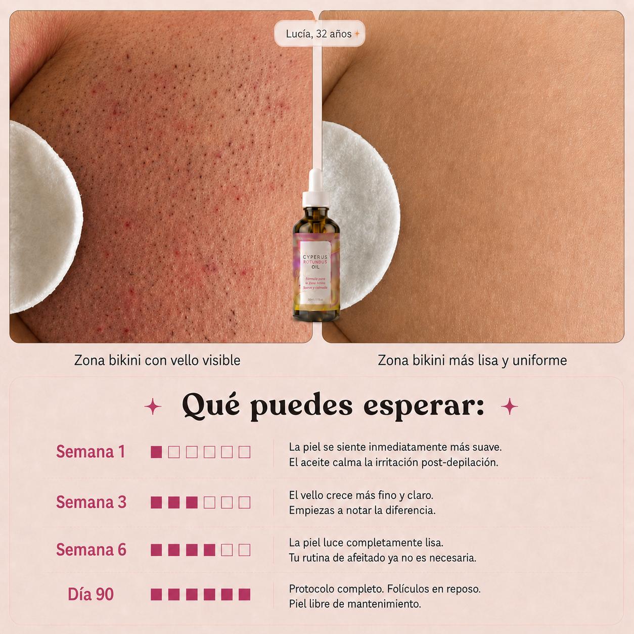 Elixir de Raíz de Cyperus™ - Depilada Forever Piernas